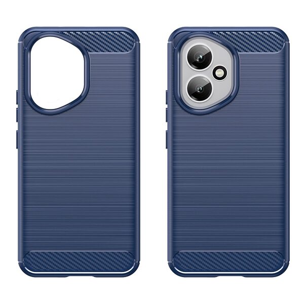 Θήκη Honor 400 5G Mad Mask Brushed TPU Carbon Πλάτη μπλε - Image 2