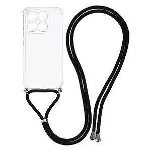 Θήκη Xiaomi 17 5G - OEM - Πλάτη TPU - Διάφανο - Λουράκι